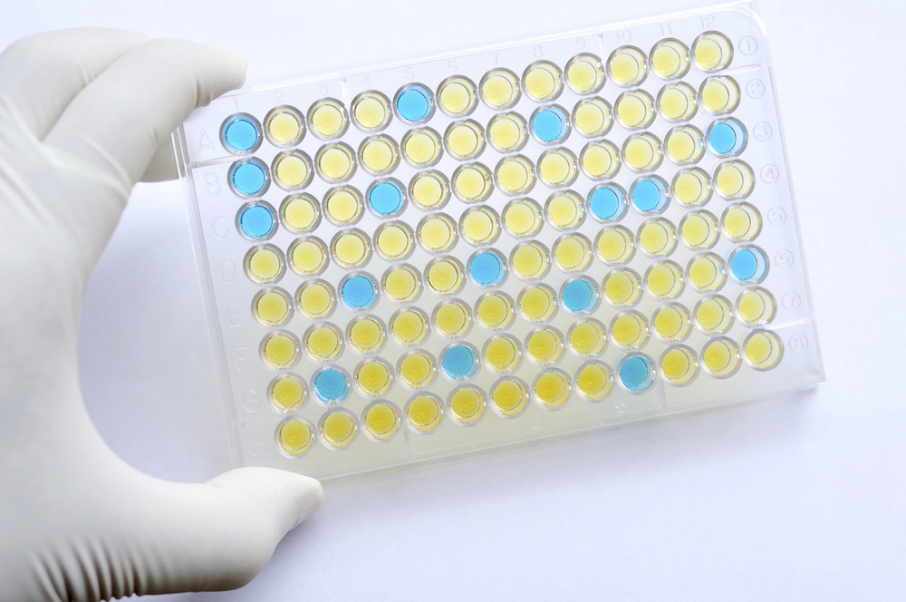Example of an ELISA assay plate